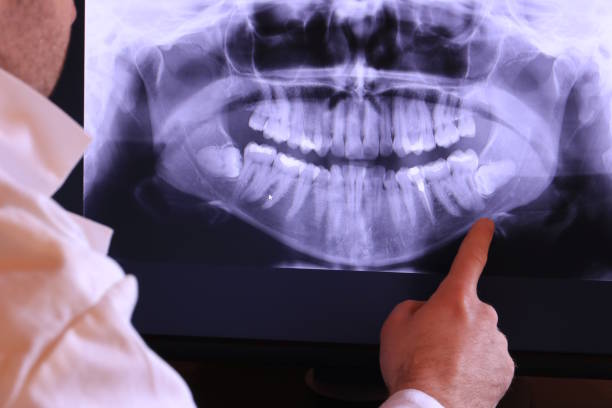 Best Emergency Denture Repair in St Simons, GA